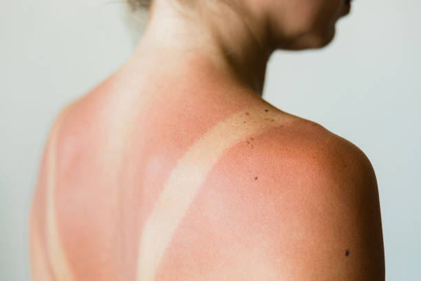 Imagen de Fabricantes After Sun